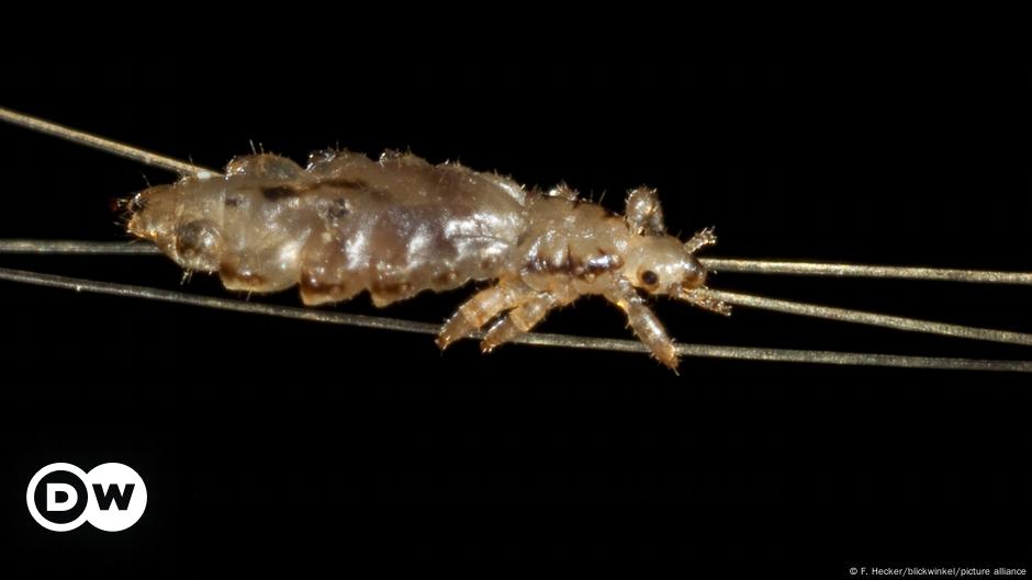 How to get rid of head&nbsp;lice